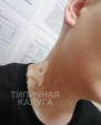«Прыгал на шею моего сына и не останавливался, пока сына не стошнило»: В Калуге жестоко избили подростка