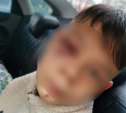 Соцсети: пойманы мигранты, избившие мальчиков в калужском Белоусове