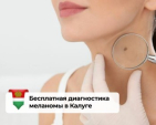 В Калуге онкодиспансер организует диагностику меланомы