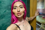 Украинка с самыми большими щеками в мире приспустила на фото надетую на голое тело кофту